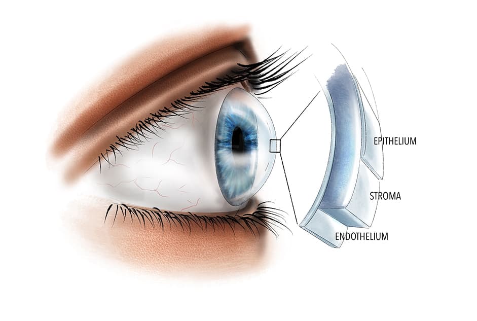 Cornea & External